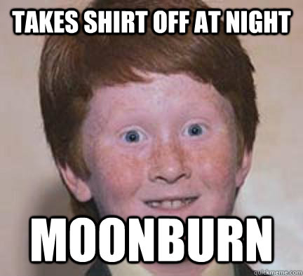 takes shirt off at night moonburn - Over Confident Ginger