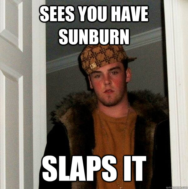 sees you have sunburn slaps it - Scumbag Steve
