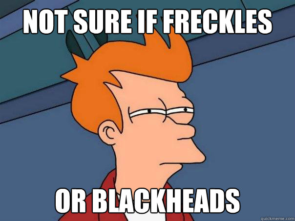 not sure if freckles or blackheads - Futurama Fry