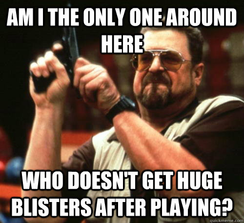 am i the only one around here who doesnt get huge blisters - Am I The Only One Around Here