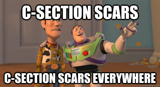 csection scars csection scars everywhere - Toy Story Everywhere