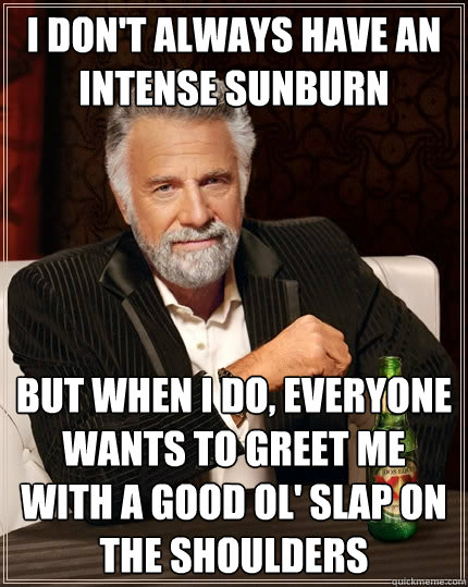 i dont always have an intense sunburn but when i do everyo - The Most Interesting Man In The World