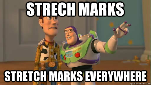 strech marks stretch marks everywhere - Everywhere
