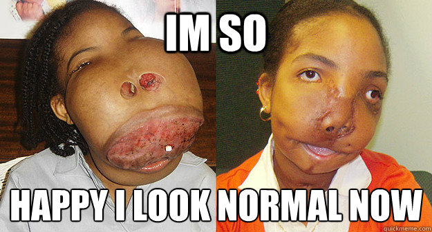 im so happy i look normal now -