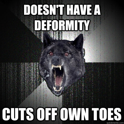 doesnt have a deformity cuts off own toes - Insanity Wolf