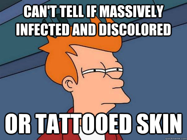 cant tell if massively infected and discolored or tattooed - Futurama Fry