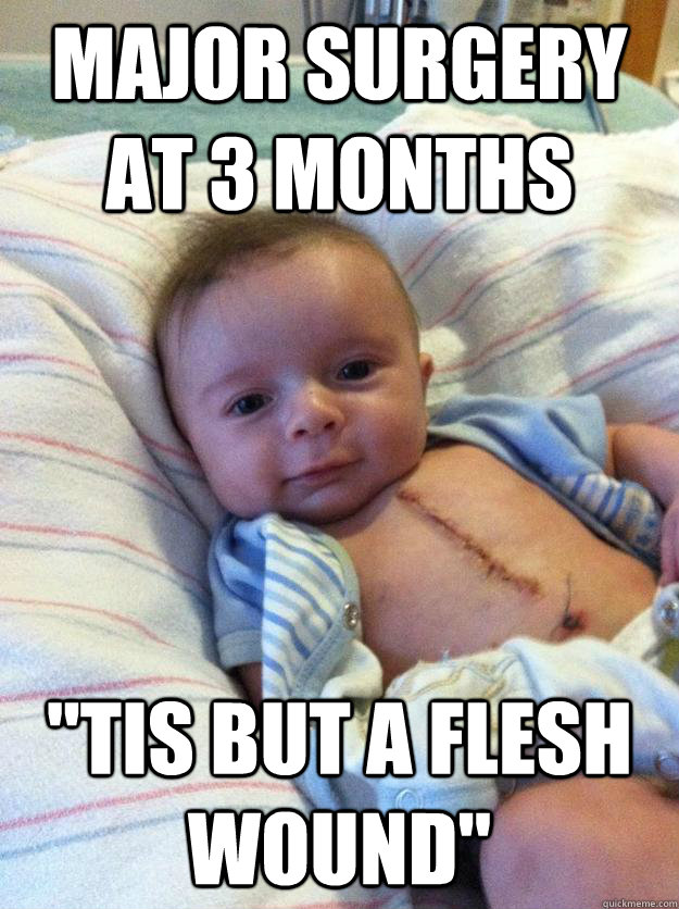 major surgery at 3 months tis but a flesh wound - Ridiculously Goodlooking Surgery Baby
