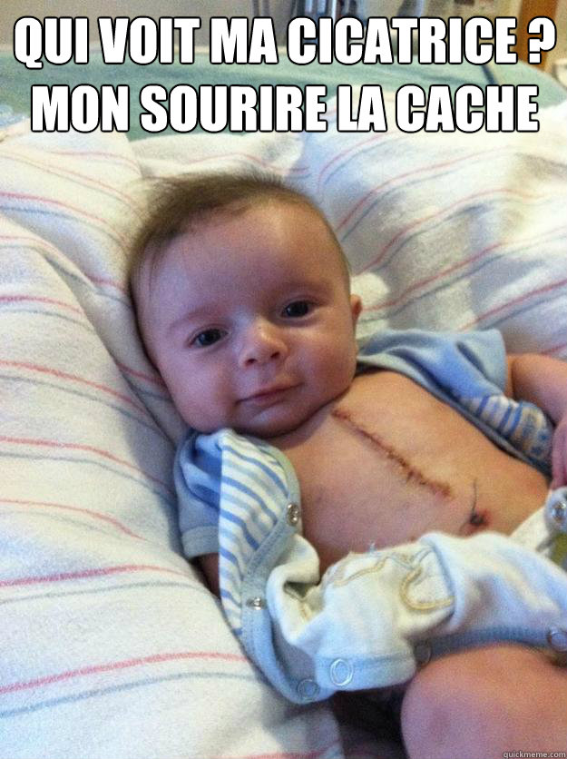 qui voit ma cicatrice mon sourire la cache - Ridiculously Goodlooking Surgery Baby