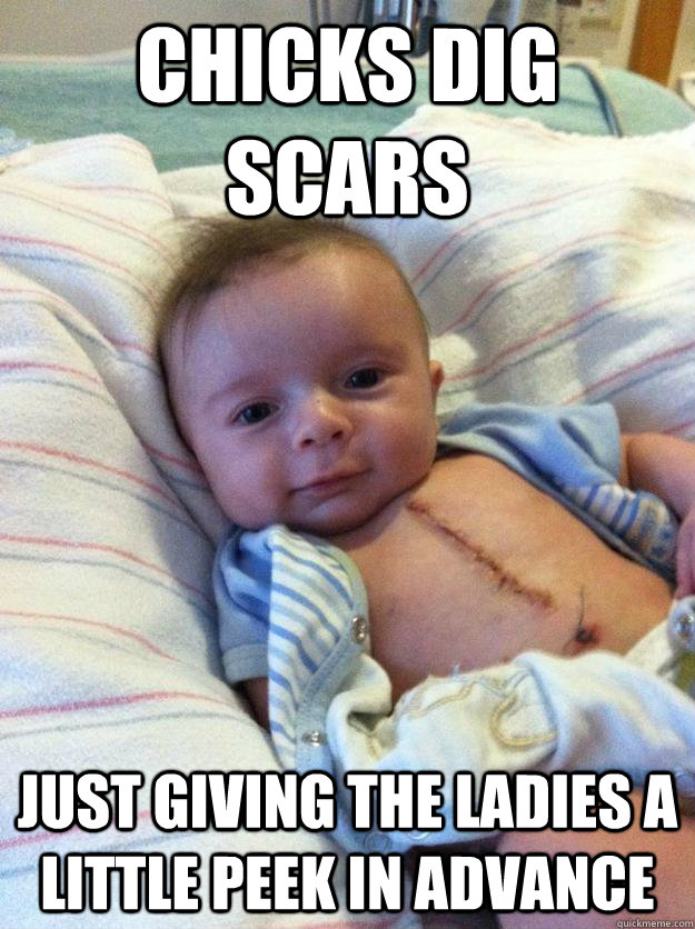 chicks dig scars just giving the ladies a little peek in adv - Ridiculously Goodlooking Surgery Baby