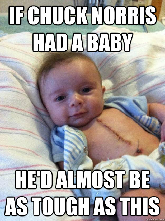 if chuck norris had a baby hed almost be as tough as this - Ridiculously Goodlooking Surgery Baby