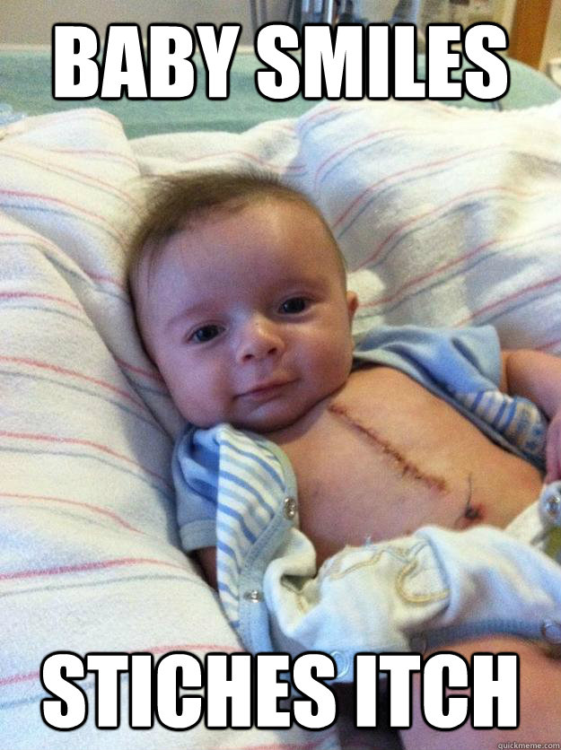baby smiles stiches itch - Ridiculously Goodlooking Surgery Baby
