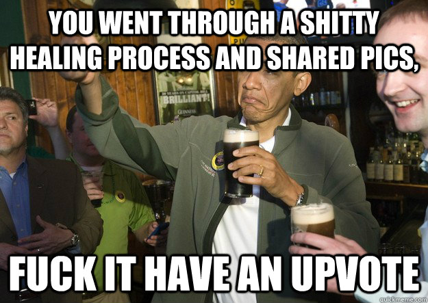 you went through a shitty healing process and shared pics f - BARACK OBAMA APPROVES