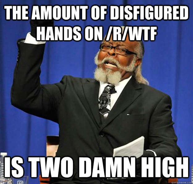 the amount of disfigured hands on rwtf is two damn high - Jimmy McMillan