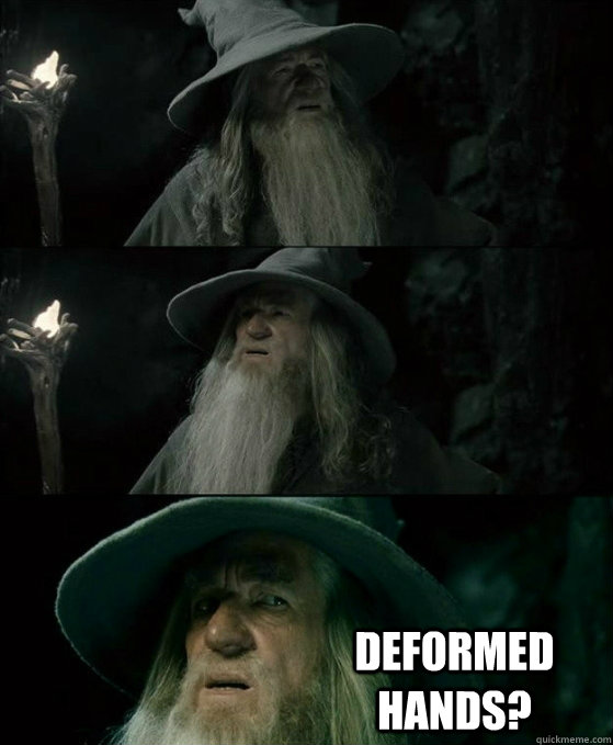 deformed hands - No memory Gandalf