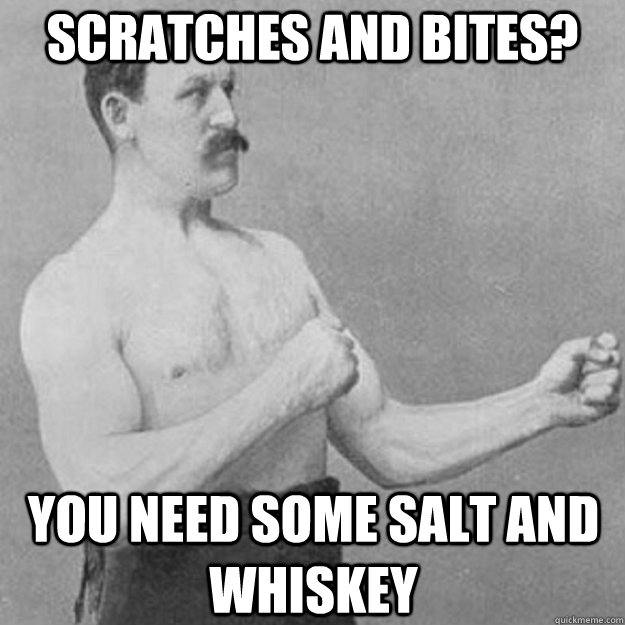 scratches and bites you need some salt and whiskey - overly manly man