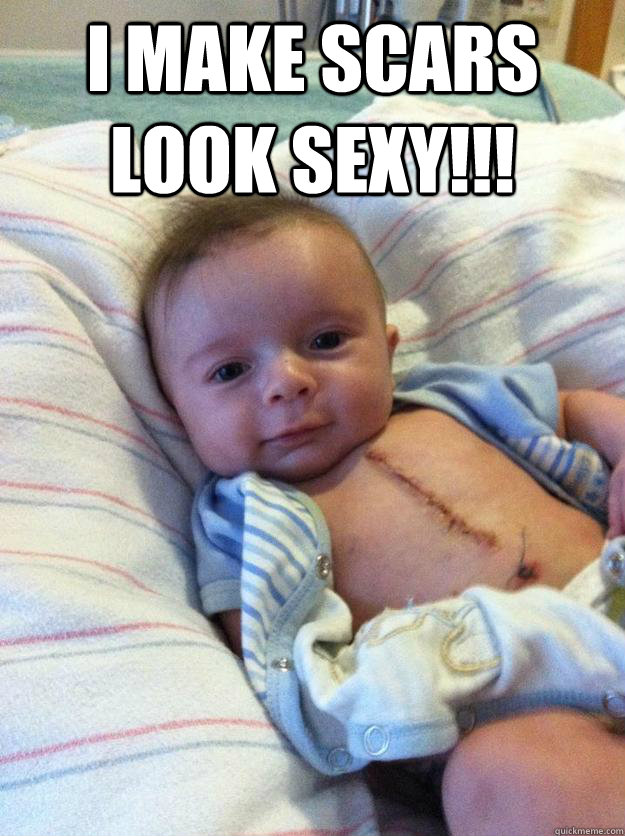 i make scars look sexy  - Ridiculously Goodlooking Surgery Baby