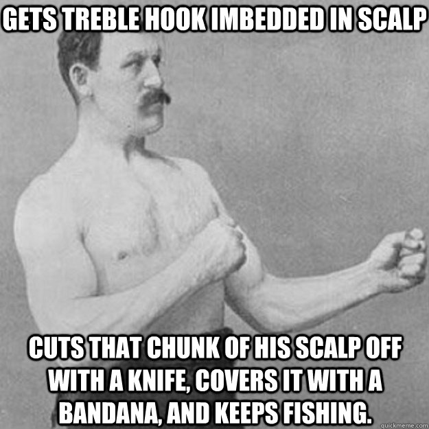 gets treble hook imbedded in scalp cuts that chunk of his sc - overly manly man