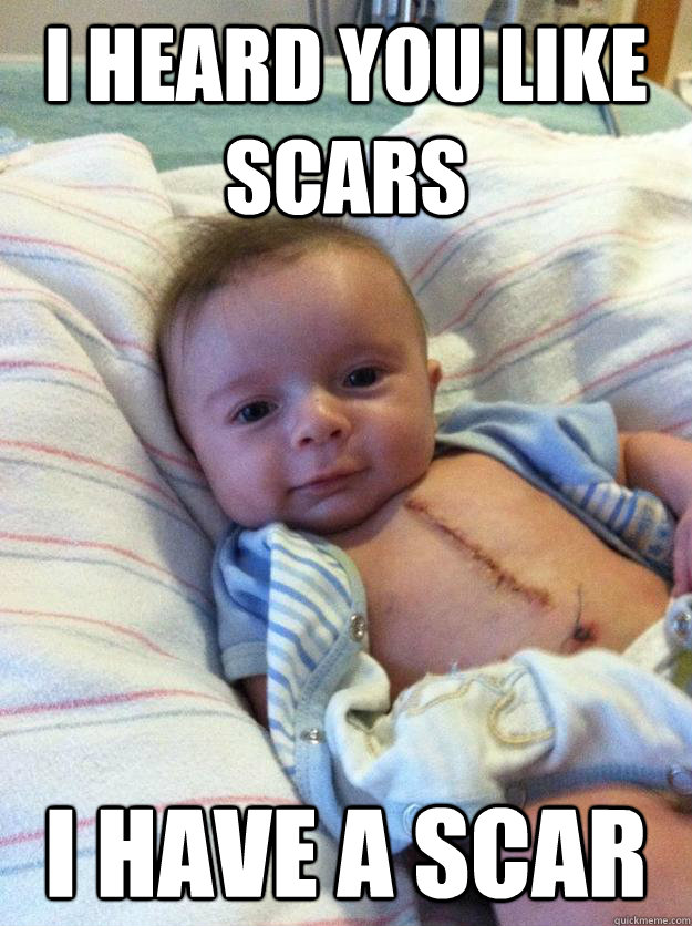 i heard you like scars i have a scar - Ridiculously Goodlooking Surgery Baby