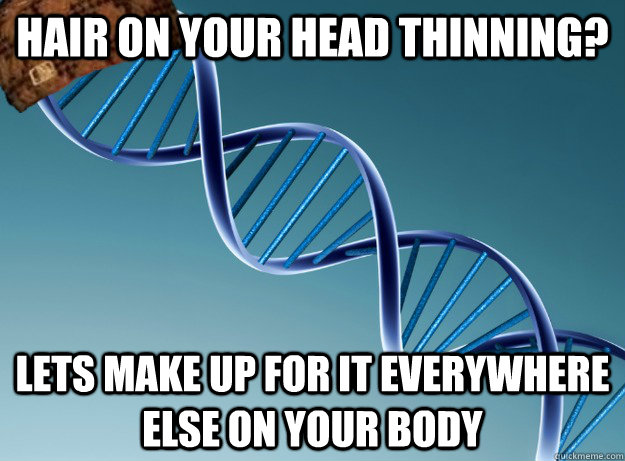 hair on your head thinning lets make up for it everywhere e - Scumbag Genetics