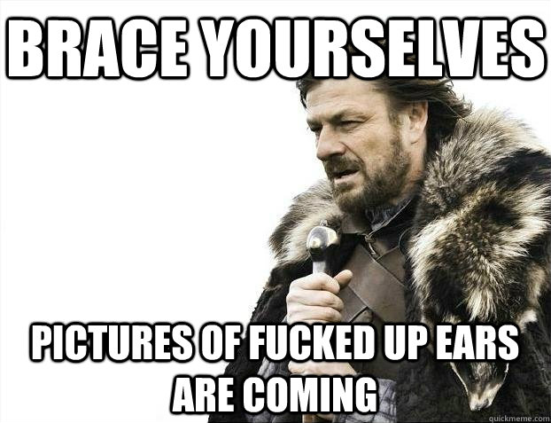 brace yourselves pictures of fucked up ears are coming - BRACEYOSELVES