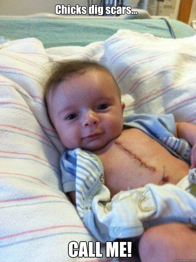 chicks dig scars call me  - Ridiculously Goodlooking Surgery Baby