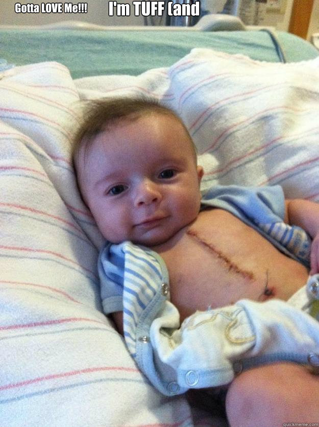 gotta love me im tuff and cute - Ridiculously Goodlooking Surgery Baby