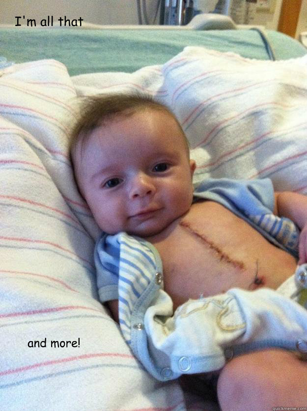 im all that and more - Ridiculously Goodlooking Surgery Baby
