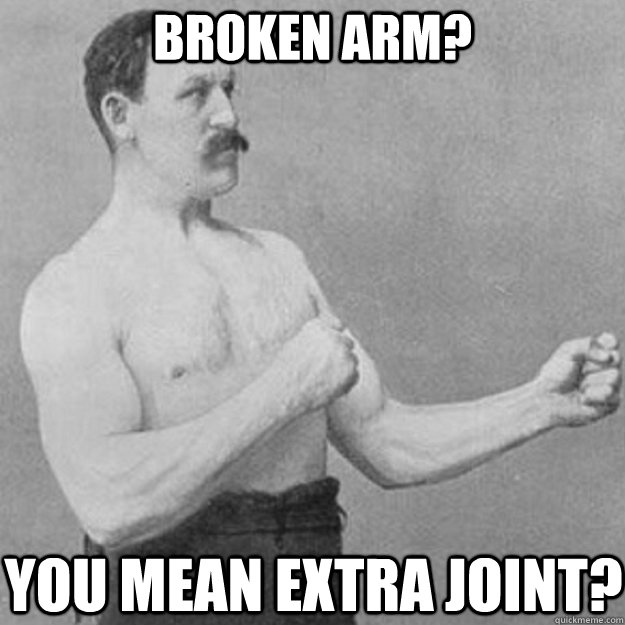 broken arm you mean extra joint - overly manly man