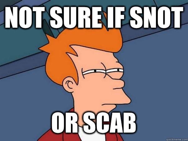 Not sure if snot Or scab - Futurama Fry