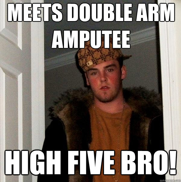 Double Arm Amputee